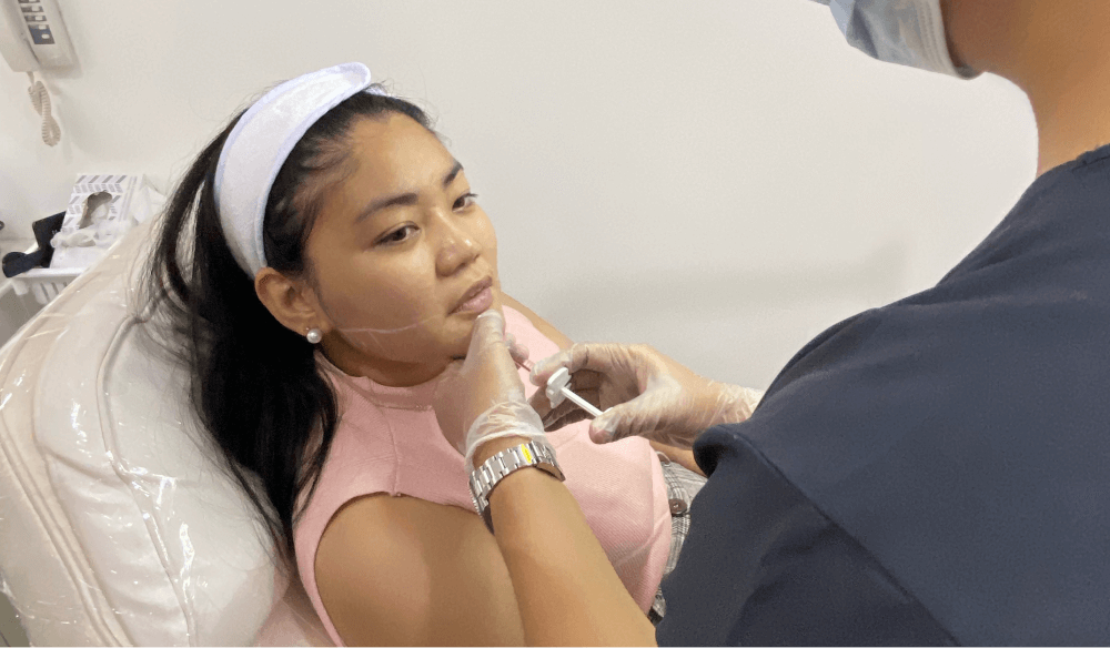 Doctor injecting the hyaluronic acid filler into my chin