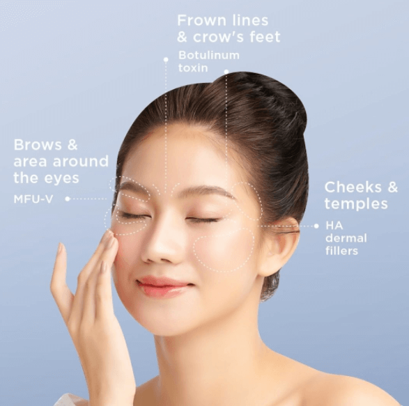 Botox and dermal filler used in combination 