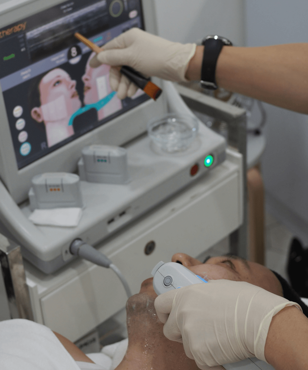 Real-time visualisation of the MFU-V Treatment